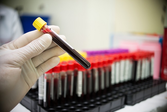 Hasil Survei Serologi : kekebalan Tubuh Kelompok Masyarakat di Kepri Telah Mencapai Herd Immunity