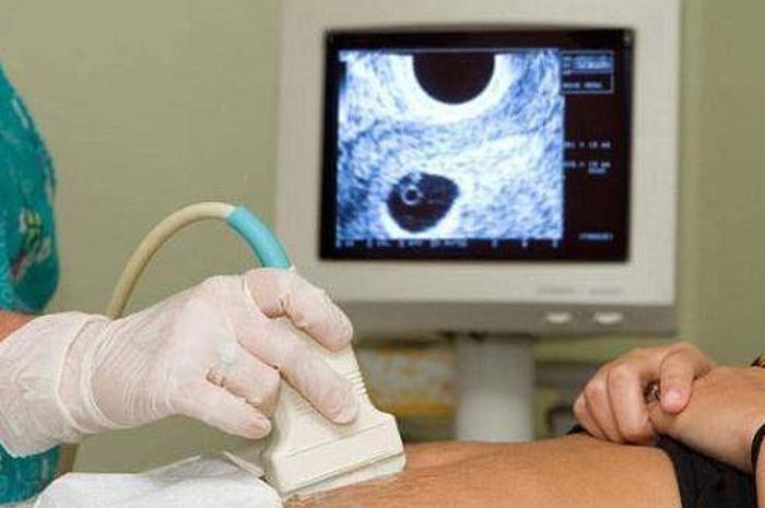Kapan Dan Seberapa Penting Pemeriksaan USG Bagi Ibu Hamil?