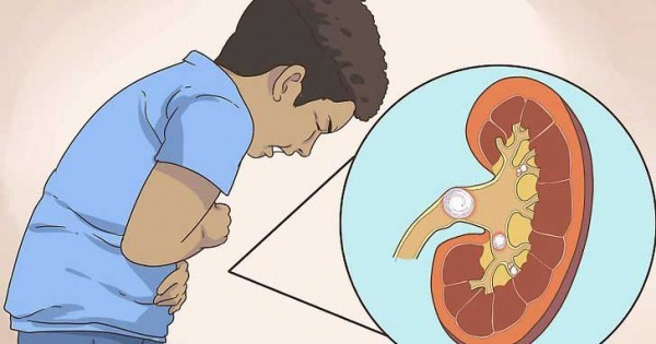 Waspada Gagal Ginjal Akut Pada Anak