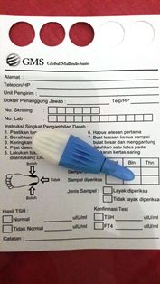 Cegah Hipotiroid pada bayi dengan Skrining Hipotiroid Kongenital (SHK)