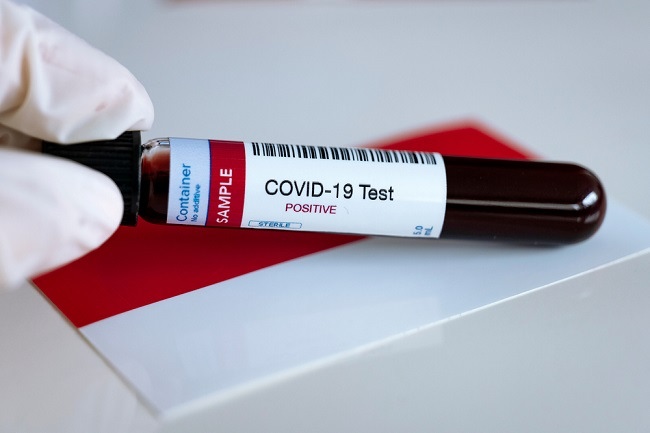 Kenali beberapa metode dalam pemeriksaan Covid-19