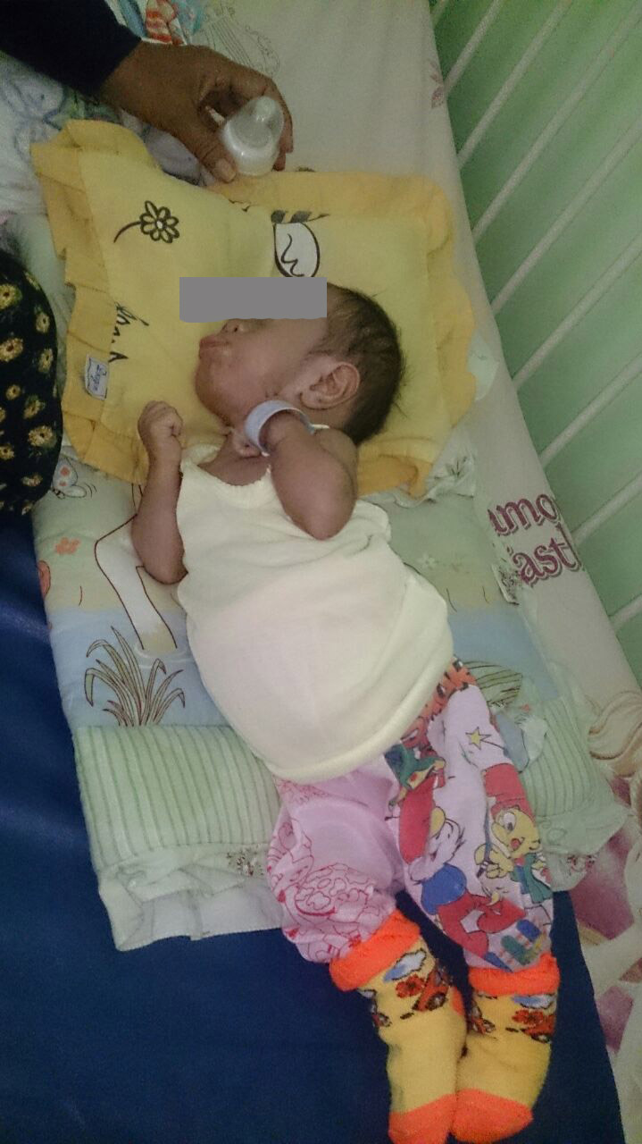 Ancaman Kasus Gizi Buruk di Sekitar Kita